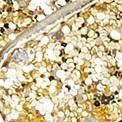 GOLD GLITTER MULTI